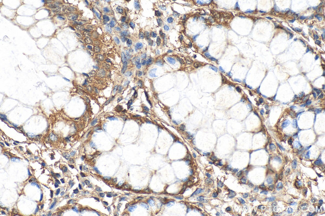 ARPM1 Antibody in Immunohistochemistry (Paraffin) (IHC (P))