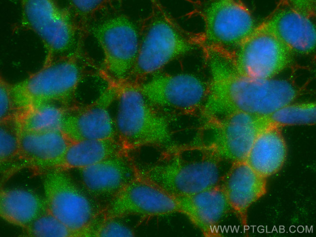 TSC2 Antibody in Immunocytochemistry (ICC/IF)