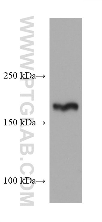 TSC2 Antibody in Western Blot (WB)