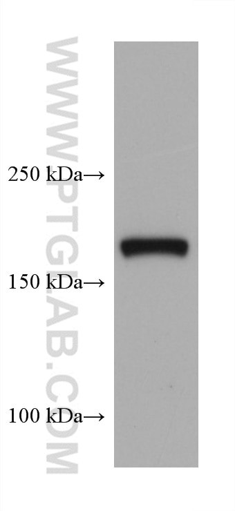 TSC2 Antibody in Western Blot (WB)