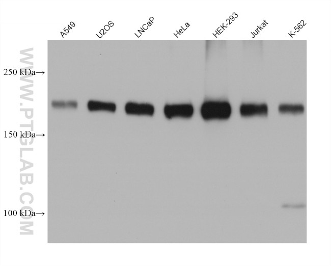 TSC2 Antibody in Western Blot (WB)