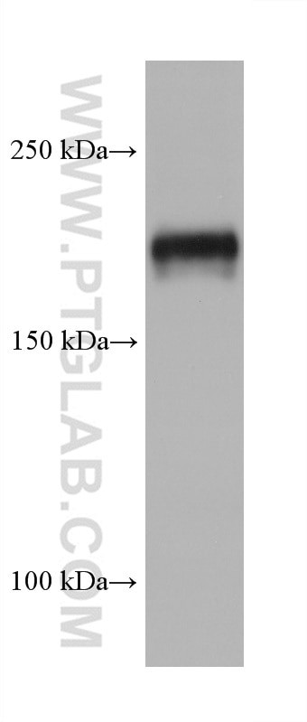 TSC2 Antibody in Western Blot (WB)