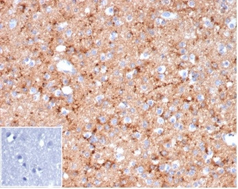 Synaptophysin Antibody in Immunohistochemistry (Paraffin) (IHC (P))