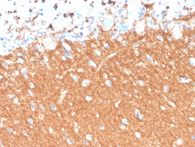 Synaptophysin Antibody in Immunohistochemistry (Paraffin) (IHC (P))