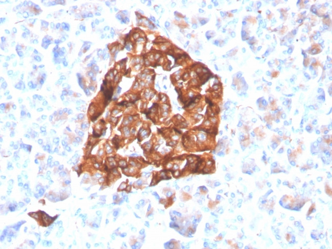 Synaptophysin Antibody in Immunohistochemistry (Paraffin) (IHC (P))