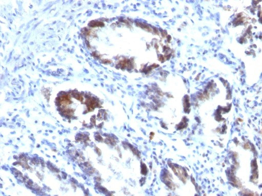 Transgelin (SM22-alpha) Antibody in Immunohistochemistry (Paraffin) (IHC (P))