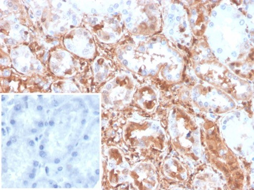 Transgelin (SM22-alpha) Antibody in Immunohistochemistry (Paraffin) (IHC (P))