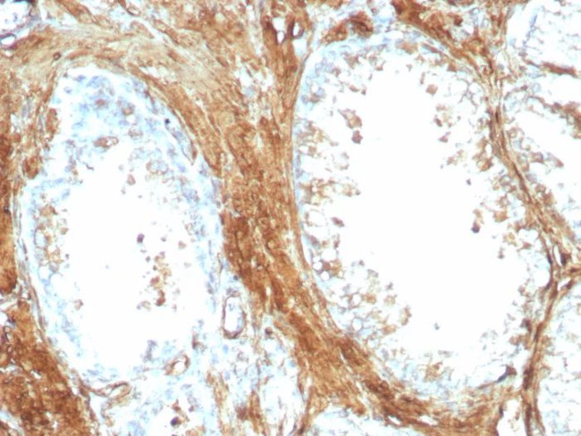 Transgelin (SM22-alpha) Antibody in Immunohistochemistry (Paraffin) (IHC (P))