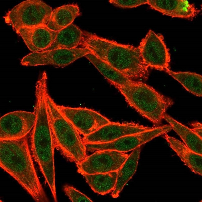 TRBP2/TARBP2 Antibody in Immunocytochemistry (ICC/IF)