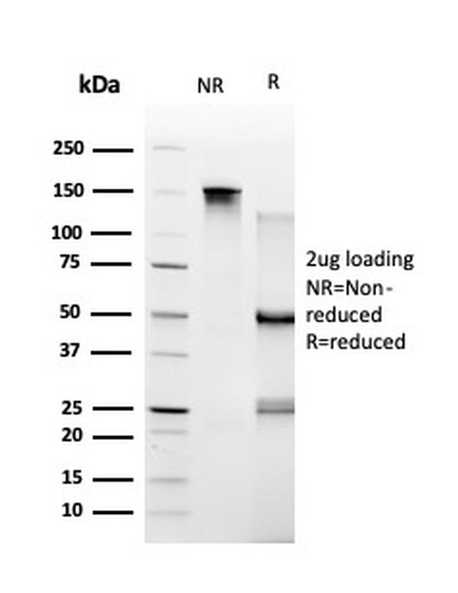 TRBP2/TARBP2 Antibody in SDS-PAGE (SDS-PAGE)