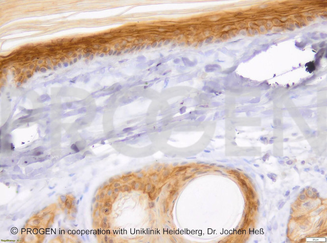 Desmoglein 1/2 Antibody in Immunohistochemistry (Paraffin) (IHC (P))