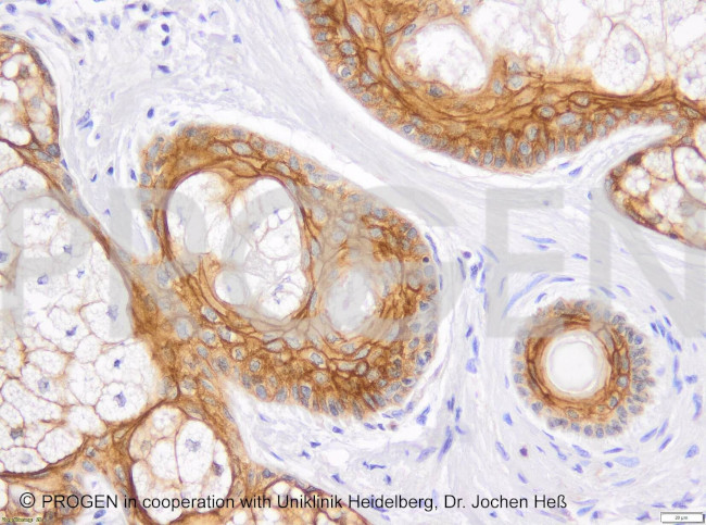 Desmoglein 1/2 Antibody in Immunohistochemistry (Paraffin) (IHC (P))