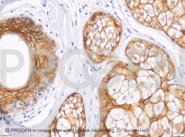 Desmoglein 1/2 Antibody in Immunohistochemistry (Paraffin) (IHC (P))