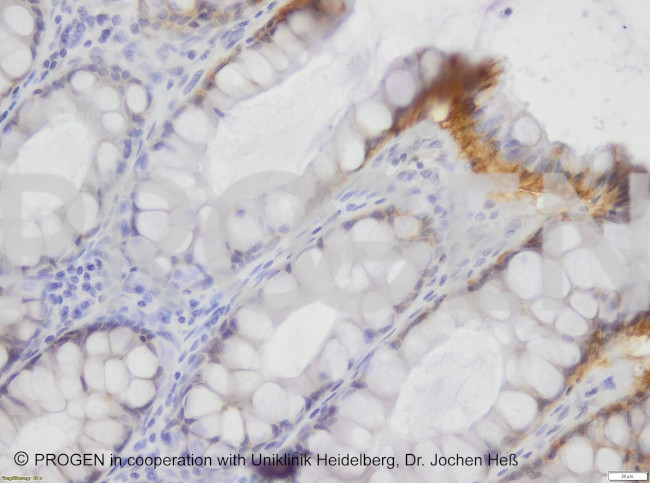 Desmoglein 1/2 Antibody in Immunohistochemistry (Paraffin) (IHC (P))