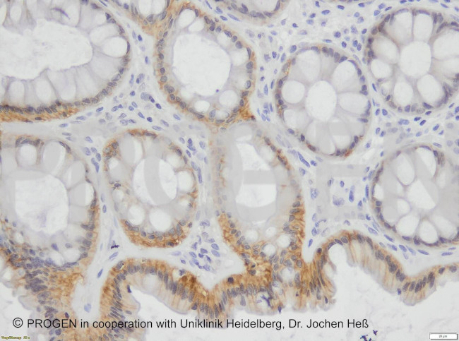 Desmoglein 1/2 Antibody in Immunohistochemistry (Paraffin) (IHC (P))