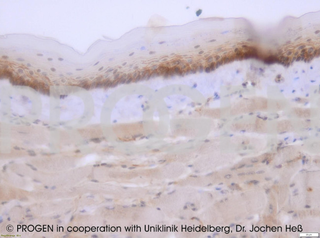 Plakoglobin Antibody in Immunohistochemistry (Paraffin) (IHC (P))