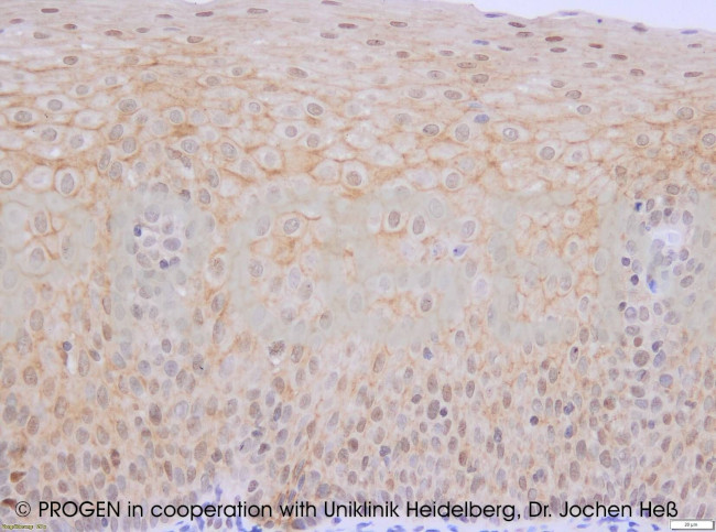 Plakoglobin Antibody in Immunohistochemistry (Paraffin) (IHC (P))