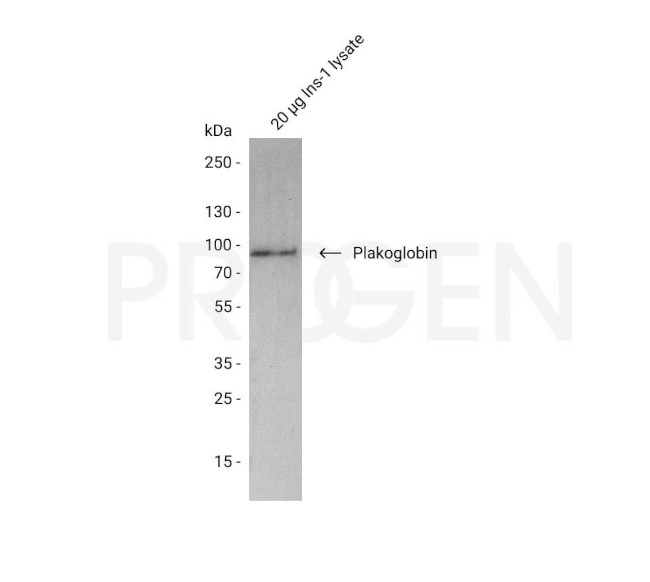 Plakoglobin Antibody in Western Blot (WB)