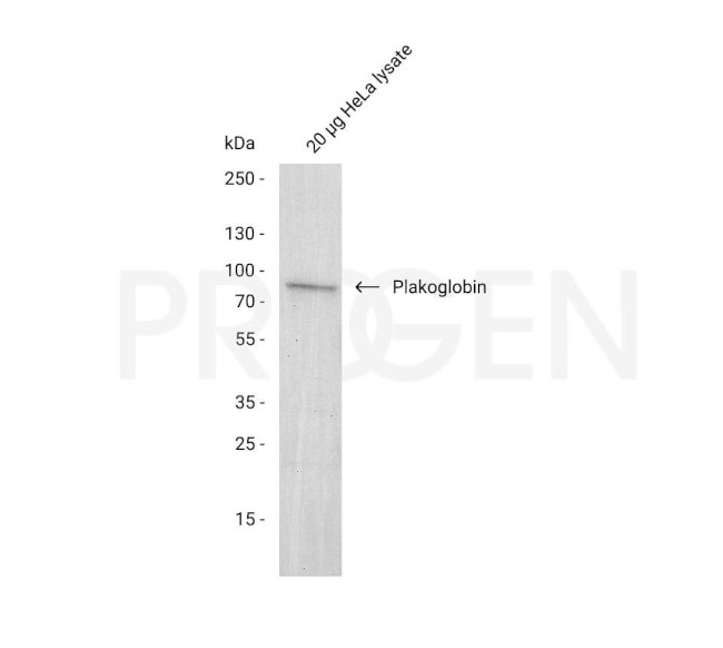 Plakoglobin Antibody in Western Blot (WB)