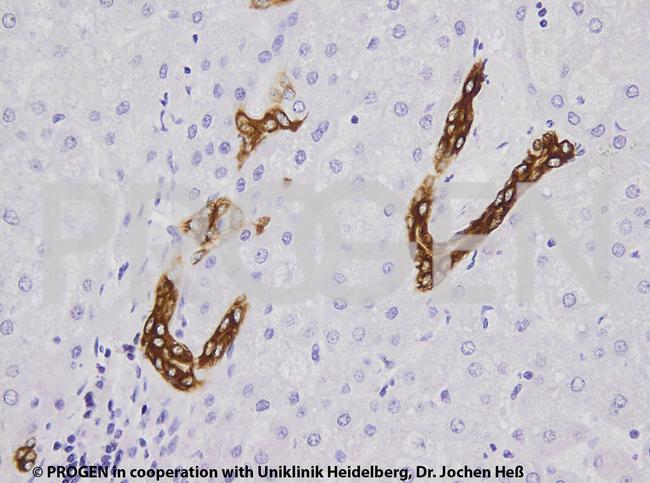 Cytokeratin 19 Antibody in Immunohistochemistry (Paraffin) (IHC (P))