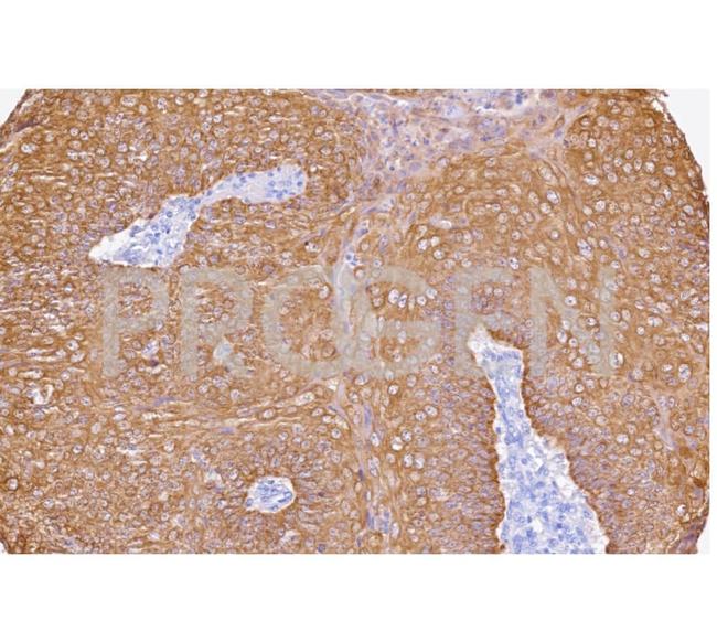 Cytokeratin 19 Antibody in Immunohistochemistry (Paraffin) (IHC (P))