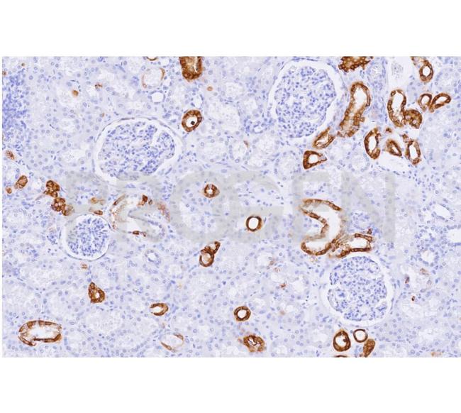 Cytokeratin 19 Antibody in Immunohistochemistry (Paraffin) (IHC (P))