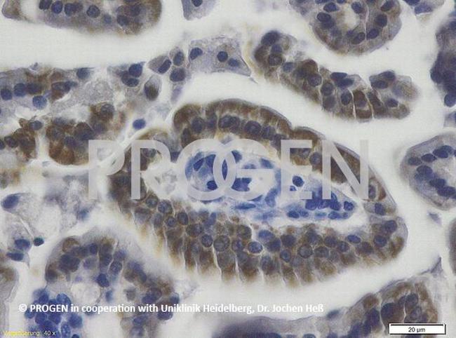 Cytokeratin 20 Antibody in Immunohistochemistry (IHC)