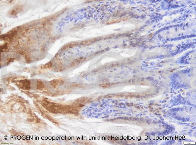 Cytokeratin 20 Antibody in Immunohistochemistry (IHC)