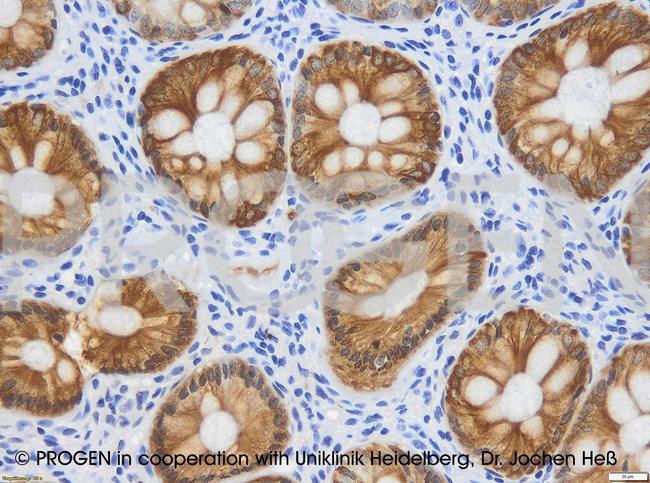 Cytokeratin 20 Antibody in Immunohistochemistry (IHC)