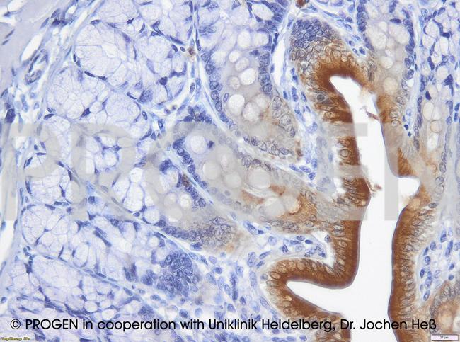 Cytokeratin 20 Antibody in Immunohistochemistry (IHC)