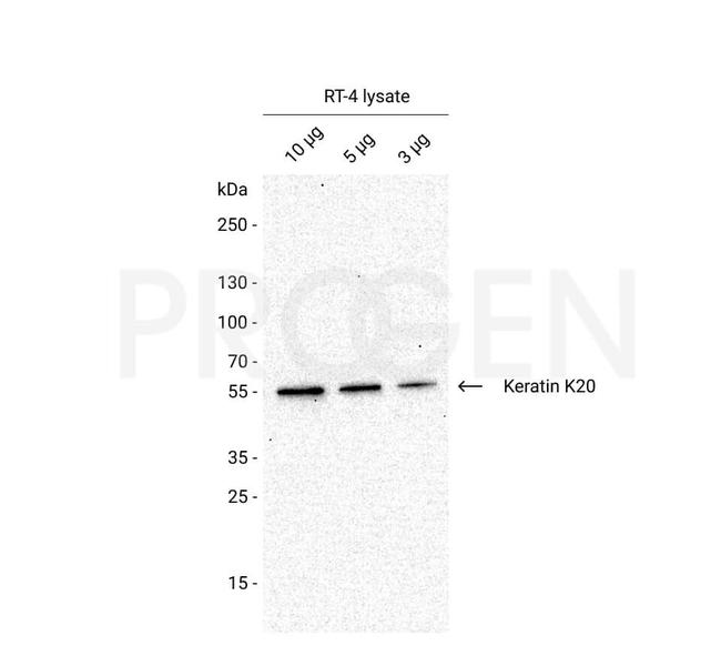 Cytokeratin 20 Antibody in Western Blot (WB)