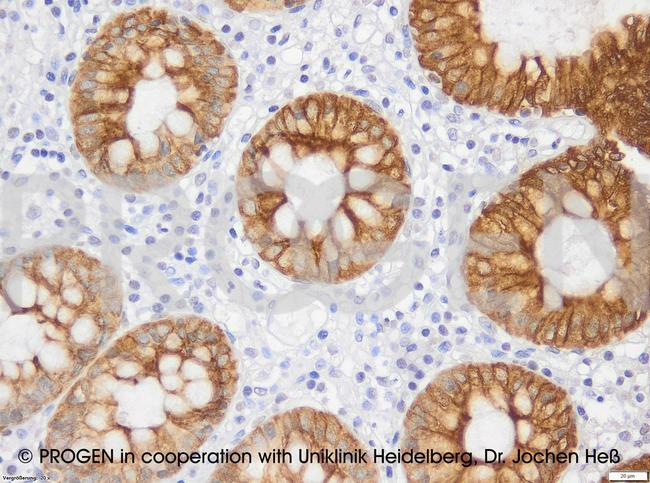 Cytokeratin 19 Antibody in Immunohistochemistry (IHC)