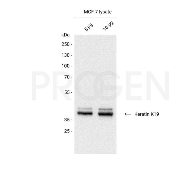 Cytokeratin 19 Antibody in Western Blot (WB)