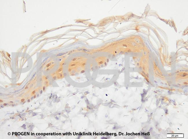 Cytokeratin 17 Antibody in Immunohistochemistry (IHC)