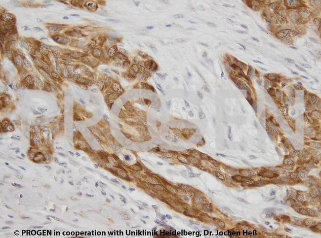 Cytokeratin 17 Antibody in Immunohistochemistry (IHC)