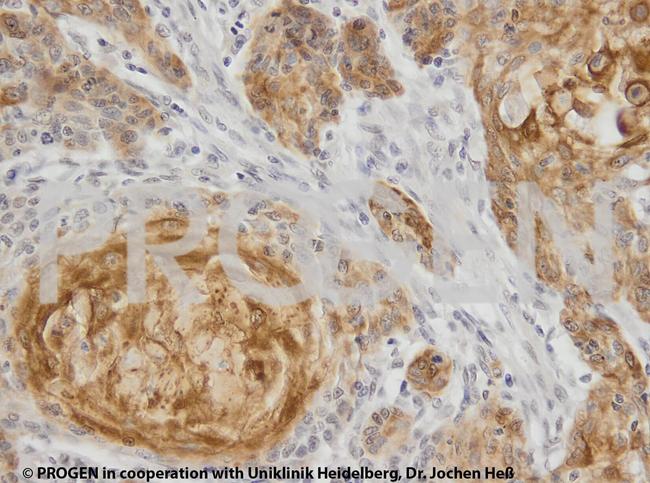 Cytokeratin 17 Antibody in Immunohistochemistry (IHC)