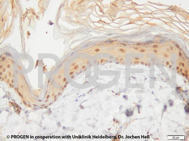 Cytokeratin 17 Antibody in Immunohistochemistry (IHC)