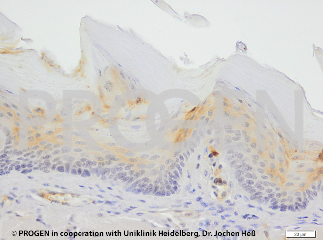 Keratin K6 Antibody in Immunohistochemistry (Paraffin) (IHC (P))