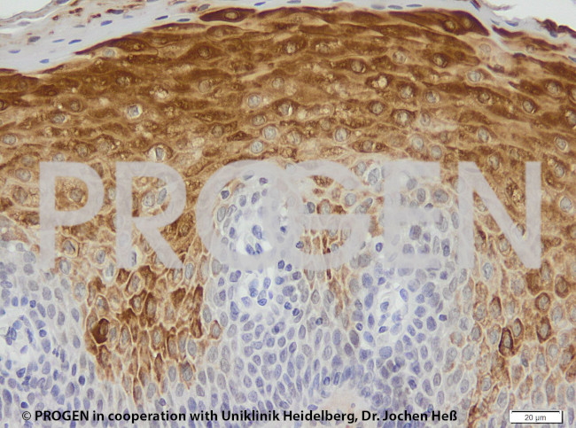 Keratin K6 Antibody in Immunohistochemistry (Paraffin) (IHC (P))