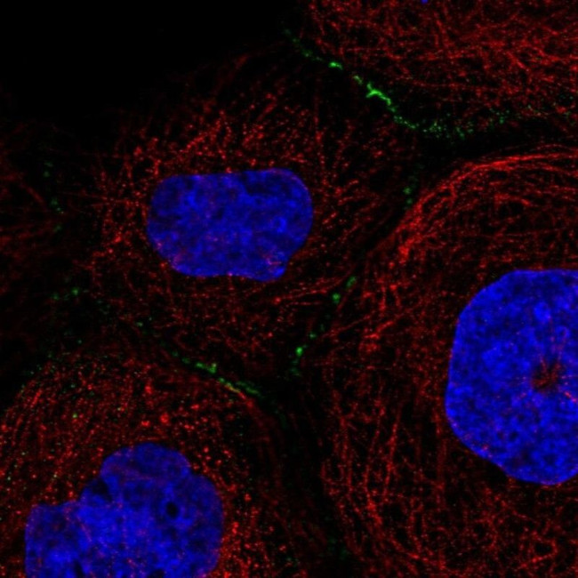 Desmocollin 3 Antibody in Immunocytochemistry (ICC/IF)