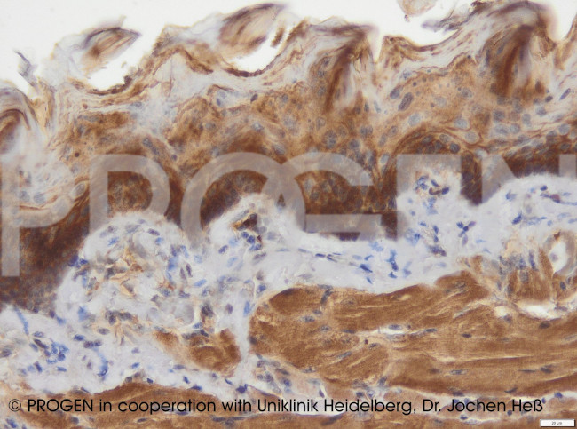 Desmocollin 3 Antibody in Immunohistochemistry (Paraffin) (IHC (P))