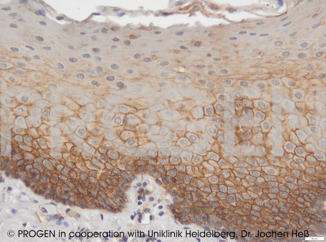 Desmocollin 3 Antibody in Immunohistochemistry (Paraffin) (IHC (P))