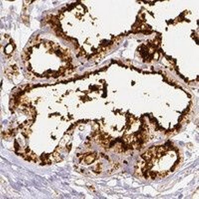 Adipophilin Antibody in Immunohistochemistry (IHC)