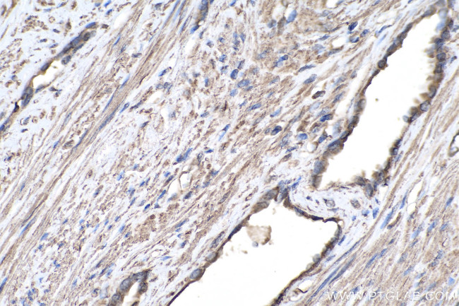 TGF beta 1 Antibody in Immunohistochemistry (Paraffin) (IHC (P))