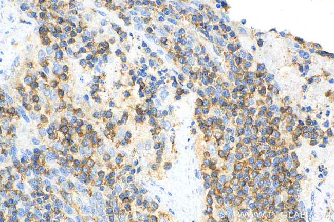 IL-10 Antibody in Immunohistochemistry (Paraffin) (IHC (P))