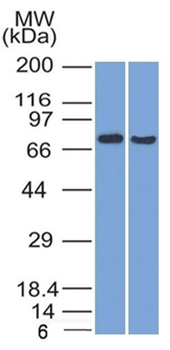 TCF4 (Transcription Factor 4) Antibody in Western Blot (WB)