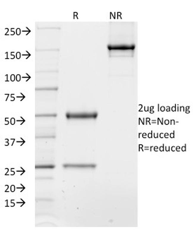 TCF4 (Transcription Factor 4) Antibody in SDS-PAGE (SDS-PAGE)