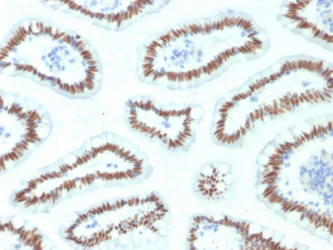 HNF1A (Pancreatic Tumor Suppressor) Antibody in Immunohistochemistry (Paraffin) (IHC (P))