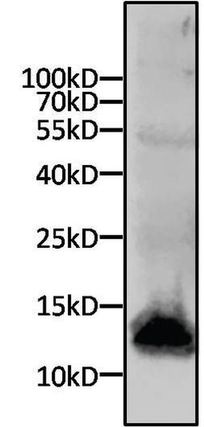 6x-His Tag Antibody in Western Blot (WB)