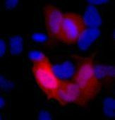 6x-His Tag Antibody in Immunocytochemistry (ICC/IF)